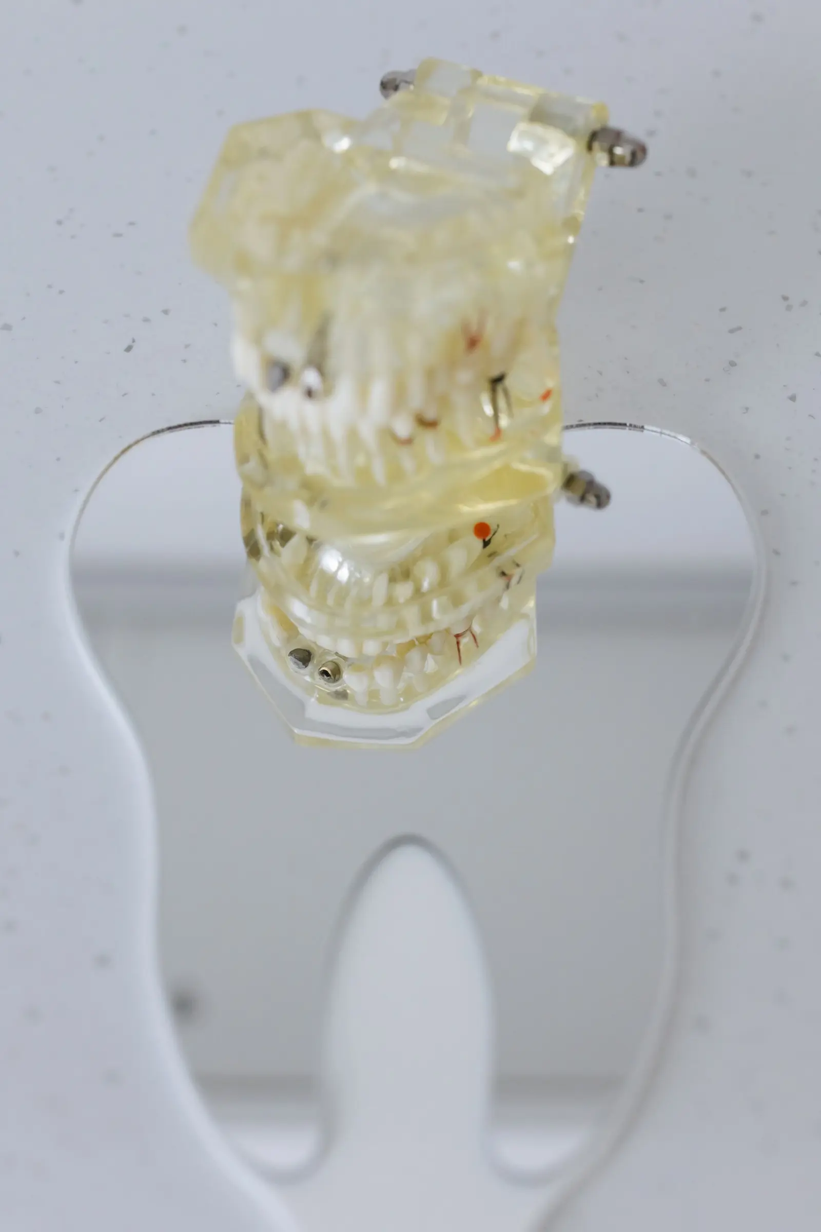 Why Gum Health Is Assessed Before Cosmetic Dental Work